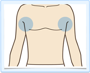 両脇・施術範囲