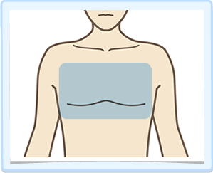 胸・施術範囲