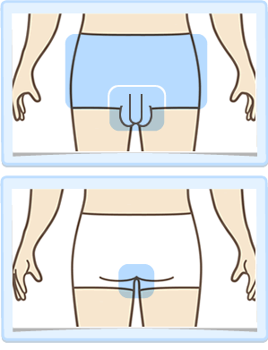 V・I・O・施術範囲